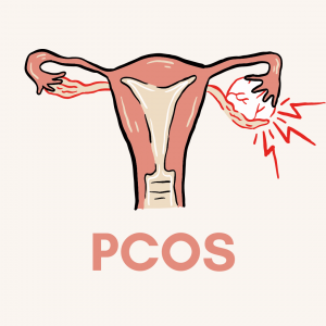Cover des Webinars PCOS in der Praxis